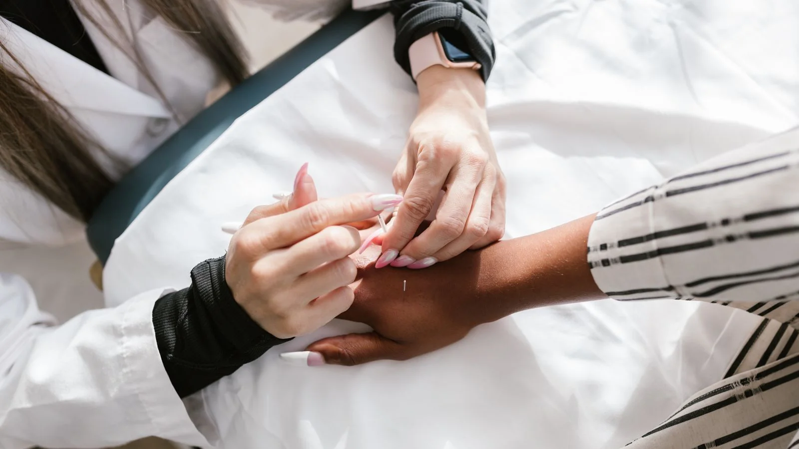 An acupuncturist working on a patient's hand, the observation-level detail a release can safely describe